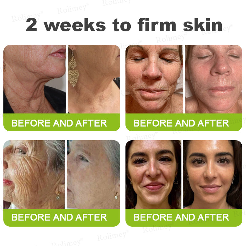 🌾LAST DAY 50% OFF- 💖Rolimey® Botox & Vita A Retinol Shot Wrinkle - Lift Tightening cream