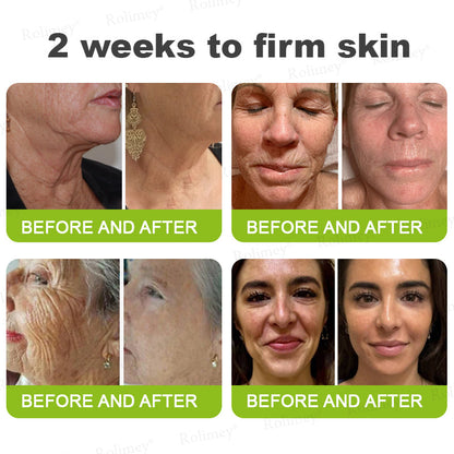 🌾LAST DAY 50% OFF- 💖Rolimey® Botox & Vita A Retinol Shot Wrinkle - Lift Tightening cream