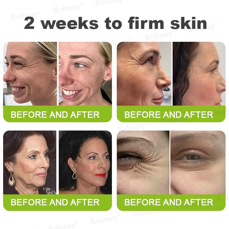 🌾LAST DAY 50% OFF- 💖Rolimey® Botox & Vita A Retinol Shot Wrinkle - Lift Tightening cream