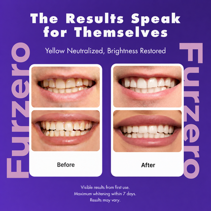 Furzero® - Purple Tooth Whitening Strips