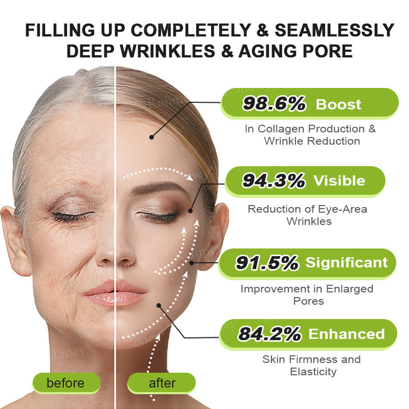 🌾LAST DAY 50% OFF- 💖Rolimey® Botox & Vita A Retinol Shot Wrinkle - Lift Tightening cream