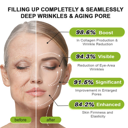 🌾LAST DAY 50% OFF- 💖Rolimey® Botox & Vita A Retinol Shot Wrinkle - Lift Tightening cream