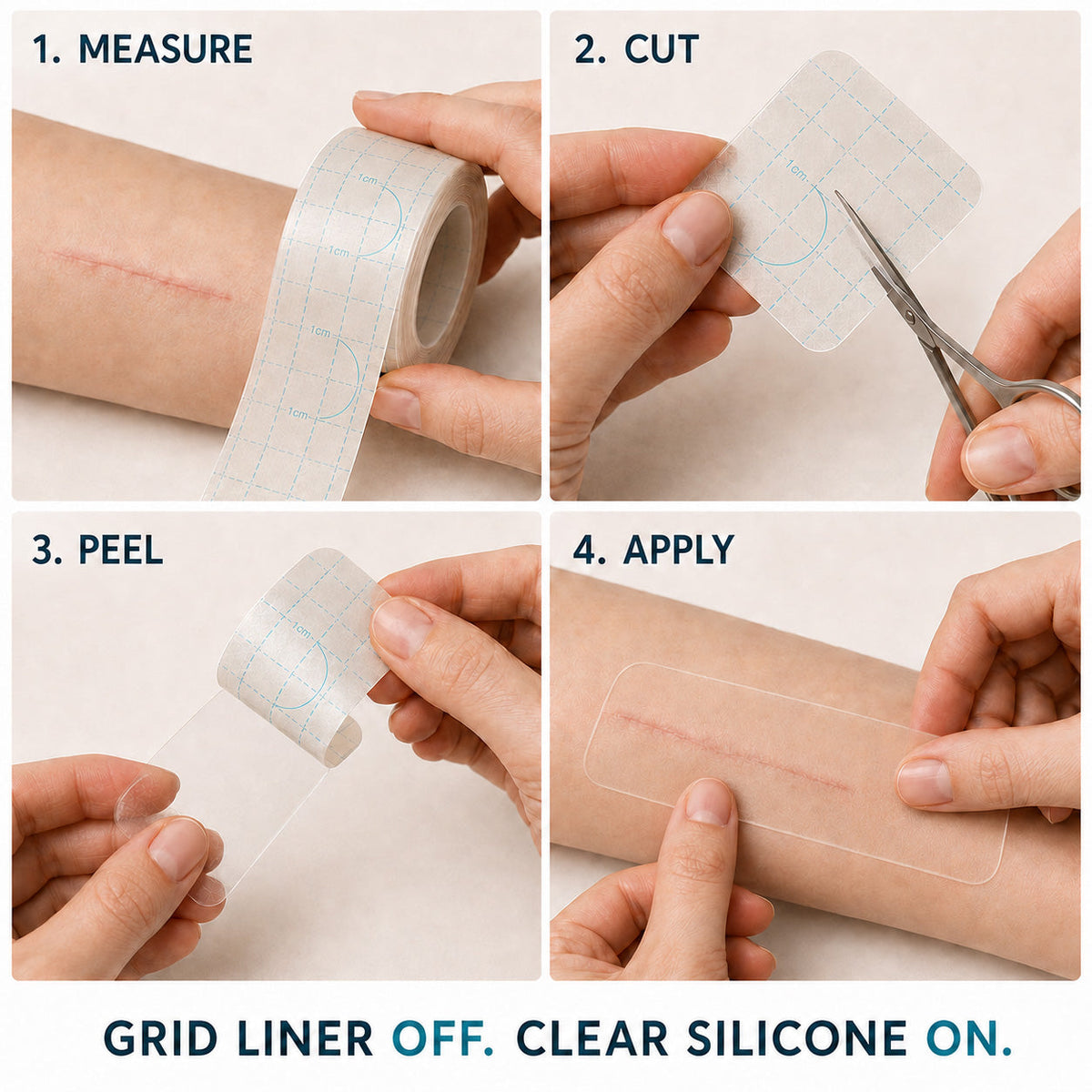 ✨💯® SILICONE SCAR THERAPY ROLL Help Soften, Flatten & Improve the Appearance of Raised Scars