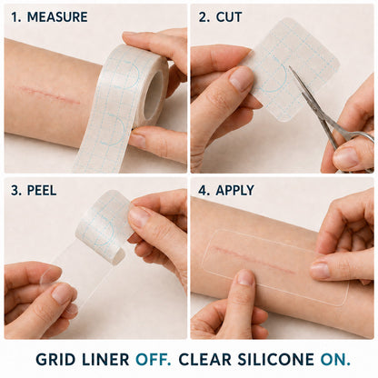 ✨💯® SILICONE SCAR THERAPY ROLL Help Soften, Flatten & Improve the Appearance of Raised Scars