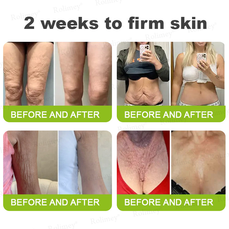🌾LAST DAY 50% OFF- 💖Rolimey® Botox & Vita A Retinol Shot Wrinkle - Lift Tightening cream