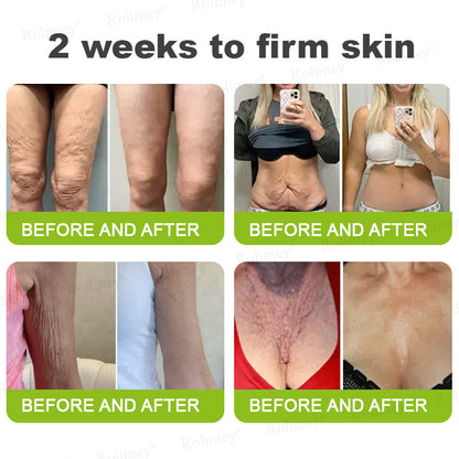 🌾LAST DAY 50% OFF- 💖Rolimey® Botox & Vita A Retinol Shot Wrinkle - Lift Tightening cream