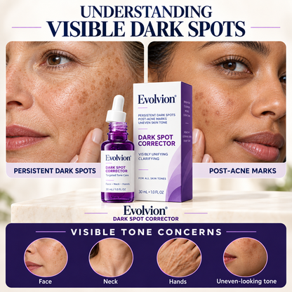 Evolvion® DARK SPOT CORRECTOR