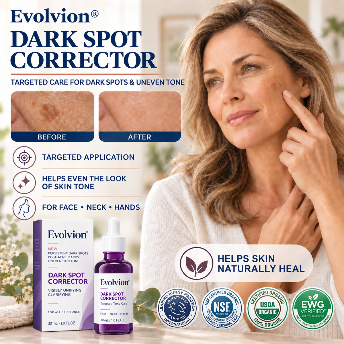 Evolvion® DARK SPOT CORRECTOR