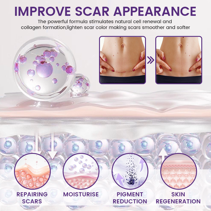 💯Evolvion®  SCAR REPAIR GEL Helps Soften, Smooth & Improve the Appearance of Raised Scars