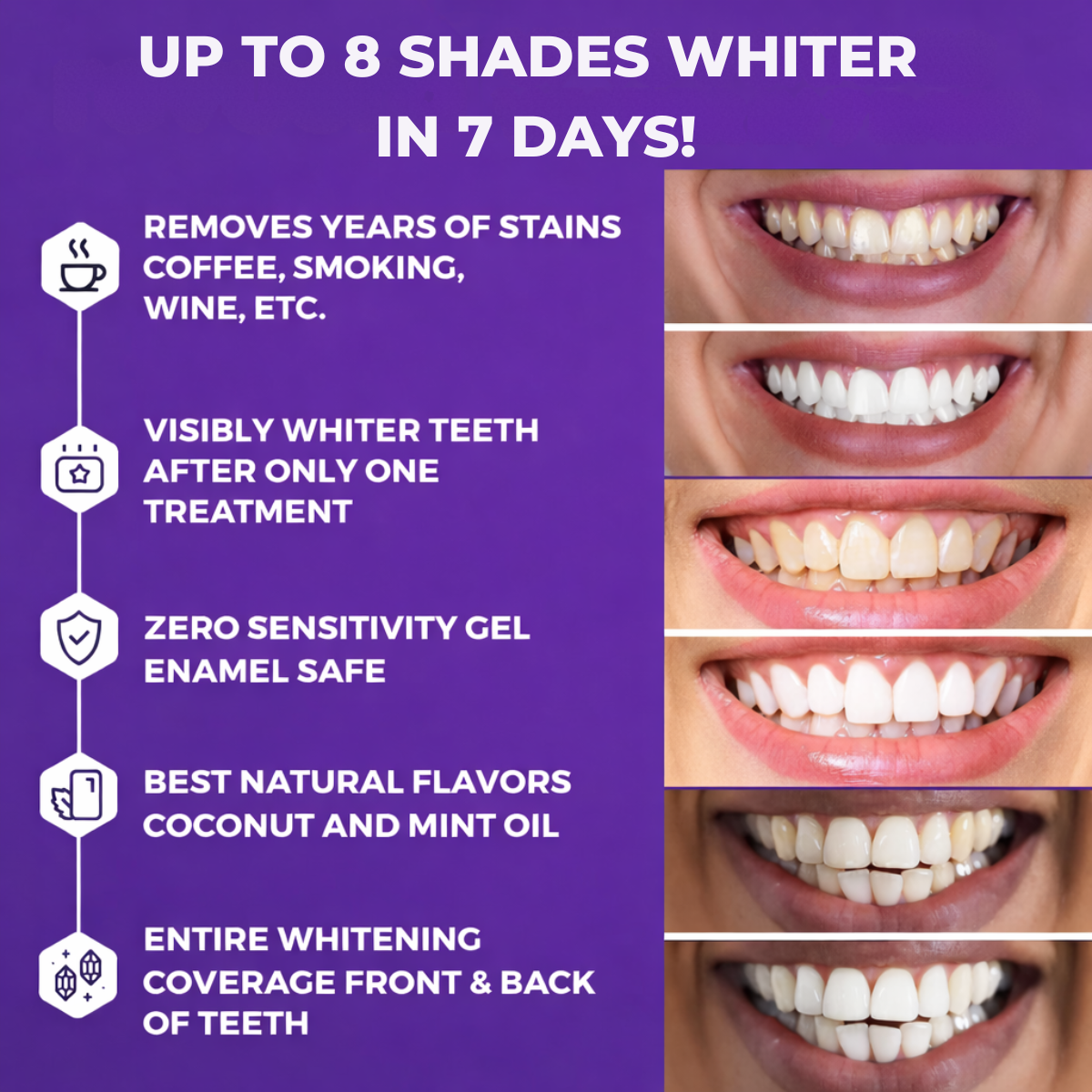 Furzero® - Purple Tooth Whitening Strips