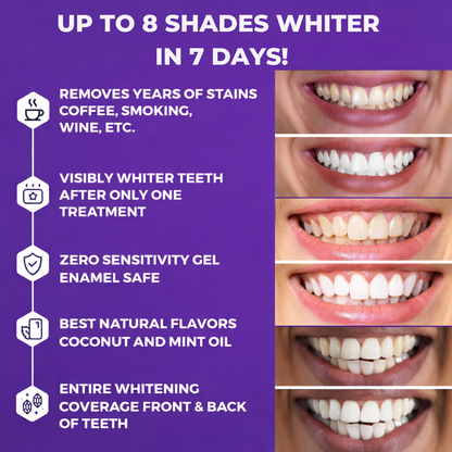 Furzero® - Purple Tooth Whitening Strips