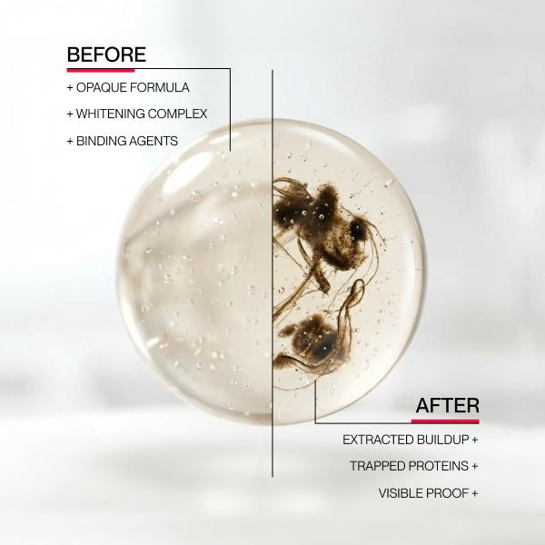 ✨Evolvion Stain Whitening Mouthwash 🌿 | Brighten Your Smile & Freshen Your Breath with Essential Oils 🦷🌬️（upsell）