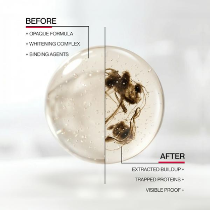 ✨Evolvion Stain Whitening Mouthwash 🌿 | Brighten Your Smile & Freshen Your Breath with Essential Oils 🦷🌬️（upsell）
